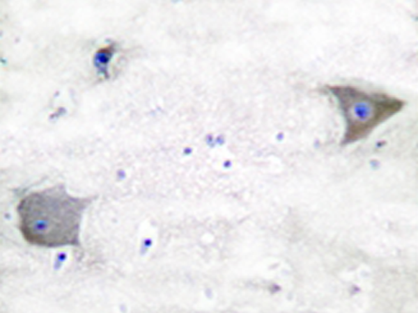 兔抗PDGFRA多克隆抗体