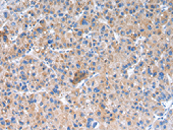 兔抗GLRA1多克隆抗体