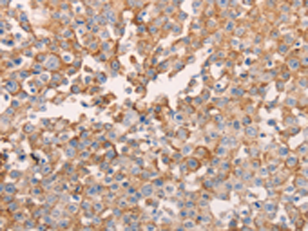 兔抗GNA11多克隆抗体
