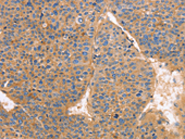 兔抗GNB1多克隆抗体