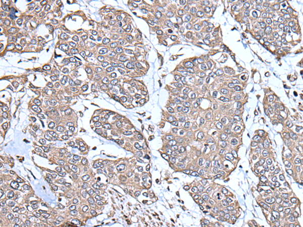 兔抗PGRMC1多克隆抗体