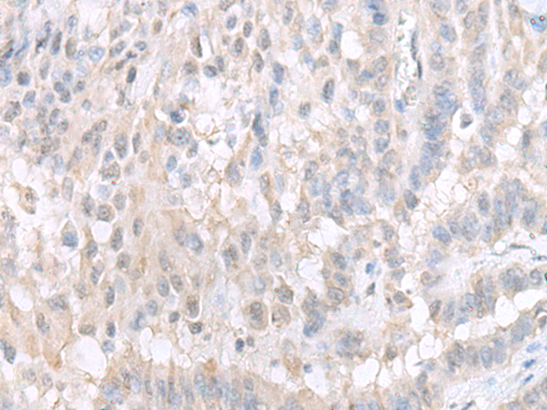 兔抗GPBP1L1多克隆抗体