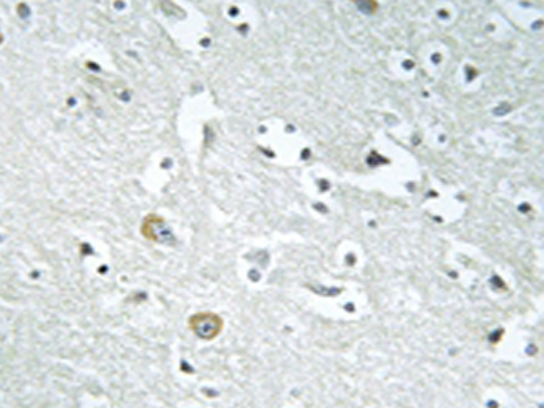 兔抗PLA1A多克隆抗体