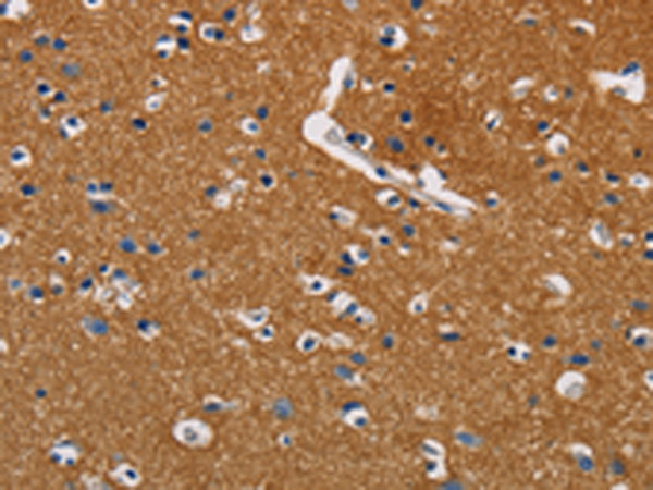 兔抗GPM6A多克隆抗体