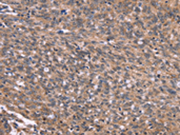 兔抗GPR65多克隆抗体