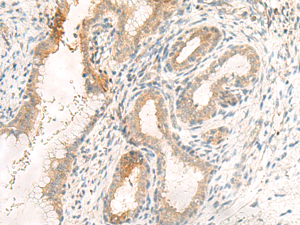 兔抗GPR89A/GPR89B多克隆抗体