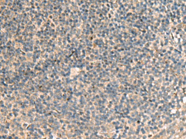 兔抗POFUT1多克隆抗体