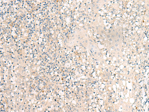 兔抗GPR149多克隆抗体