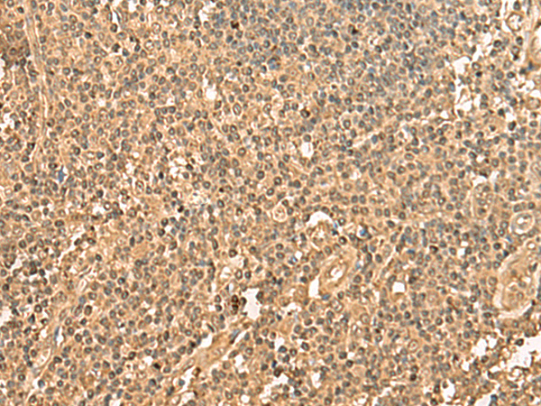 兔抗PPM1G多克隆抗体