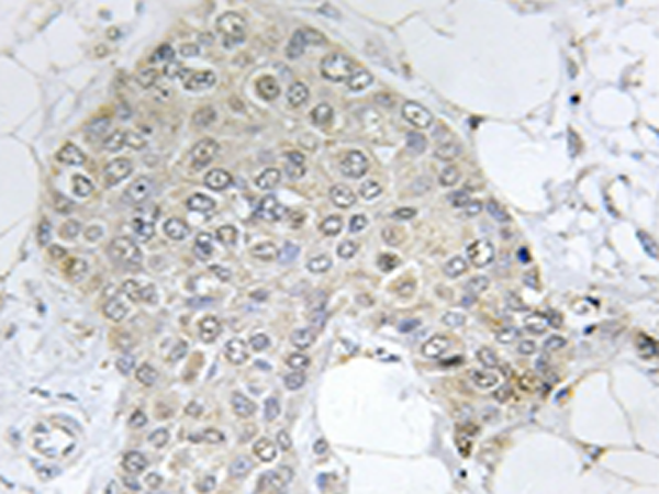 兔抗PPP1R2(Ab-120121)多克隆抗体