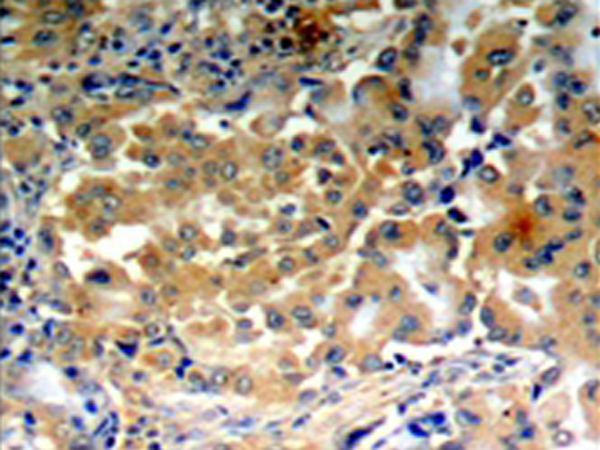 兔抗PRKCZ(Phospho-Thr410)多克隆抗体
