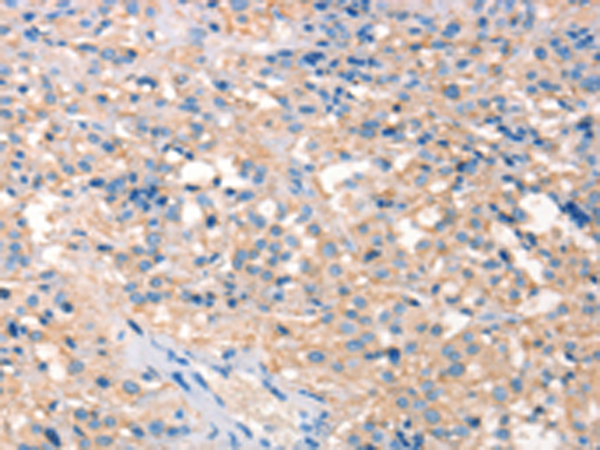 兔抗PRPS1 2 1L1多克隆抗体