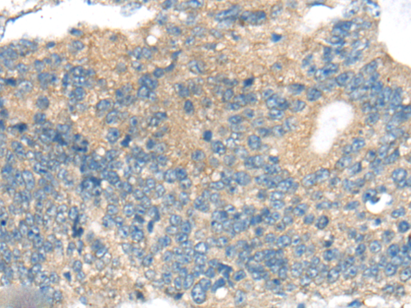 兔抗CNTNAP1多克隆抗体