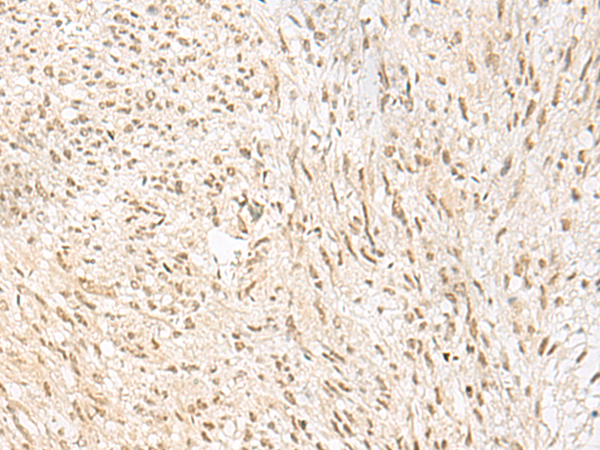 兔抗PSPC1多克隆抗体