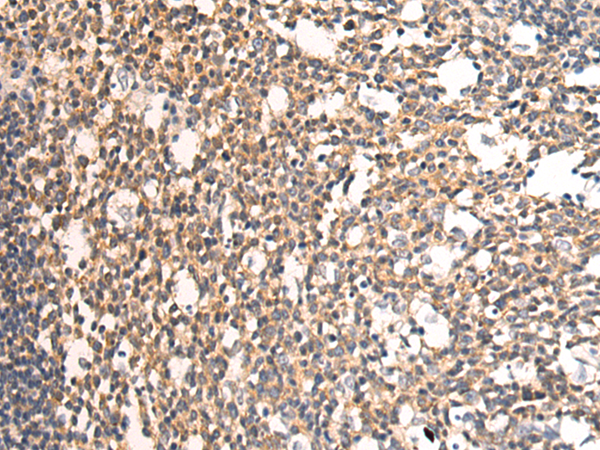 兔抗PTCD3多克隆抗体