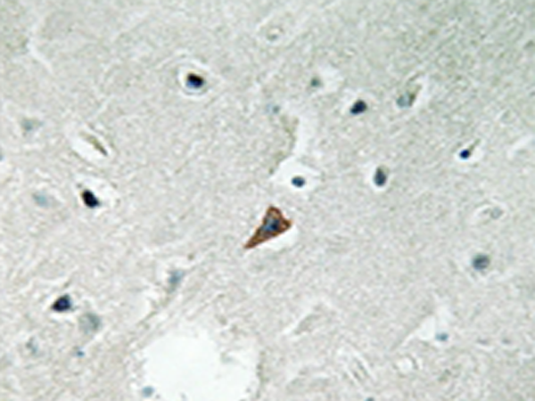 兔抗PTK2B(Phospho-Tyr579)多克隆抗体