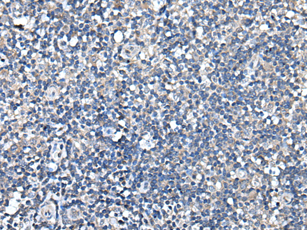 兔抗TRIM23多克隆抗体