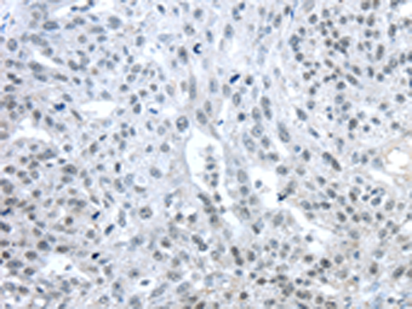 兔抗TRIM33多克隆抗体