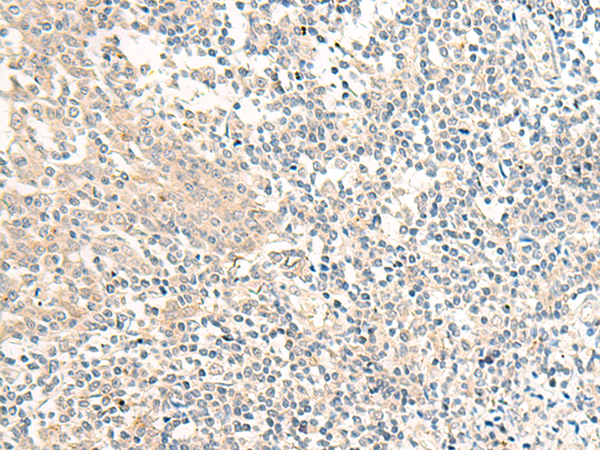 兔抗GPR161多克隆抗体