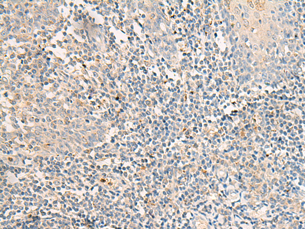 兔抗GPR176多克隆抗体