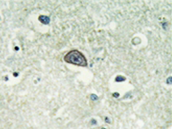 兔抗GRIN1(Phospho-Ser890)多克隆抗体