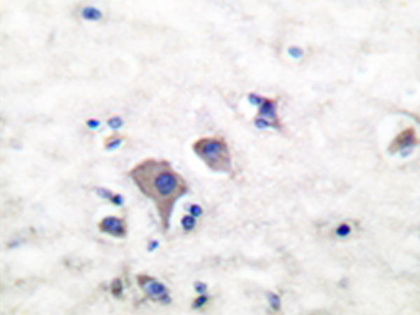 兔抗GRM2/3多克隆抗体