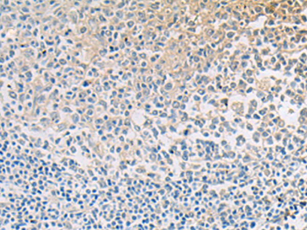 兔抗SLC23A1多克隆抗体