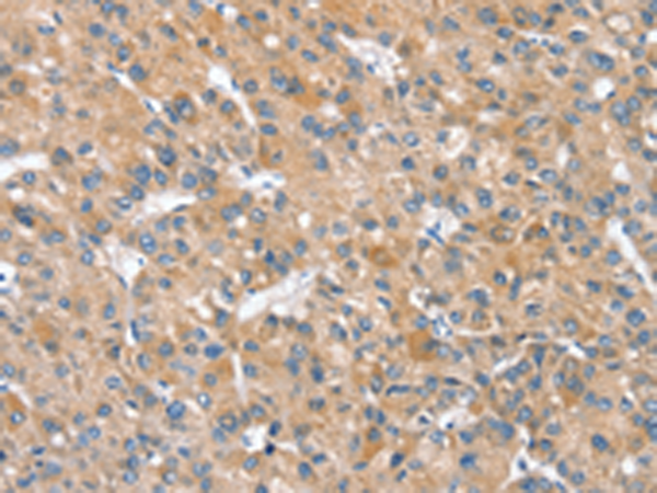 兔抗SLC25A2多克隆抗体