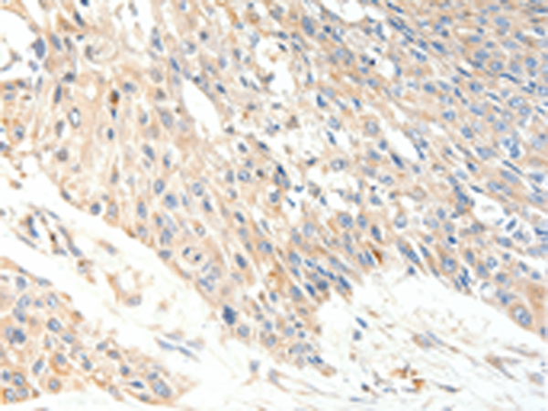兔抗SLC27A1多克隆抗体
