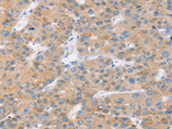 兔抗SLC27A2多克隆抗体