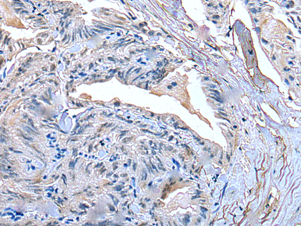 兔抗SLC27A4多克隆抗体