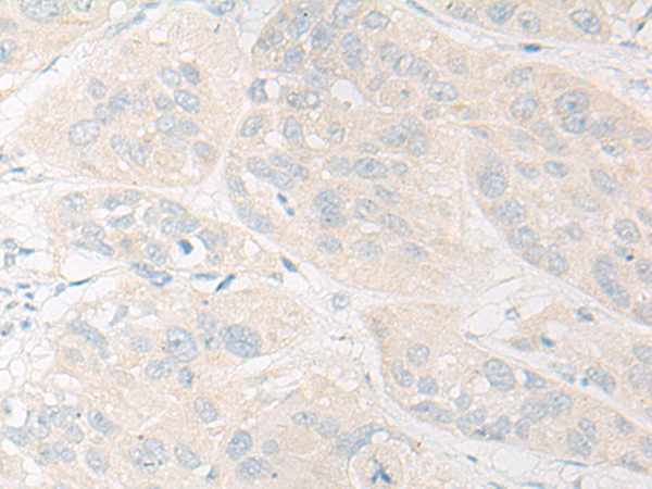 兔抗SLC28A2多克隆抗体