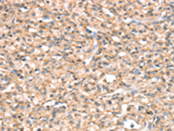 兔抗SLC32A1多克隆抗体