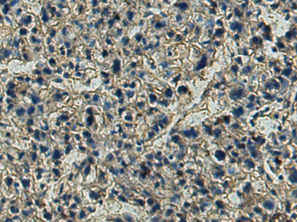 兔抗SLC39A5多克隆抗体