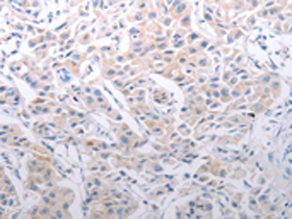 兔抗SLC39A6多克隆抗体