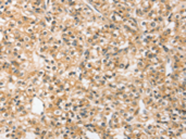 兔抗SLC44A2多克隆抗体