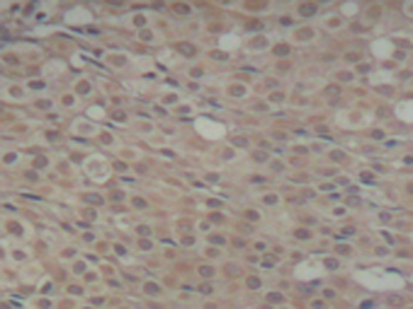 兔抗SMAD3 (Phospho-Ser425)多克隆抗体