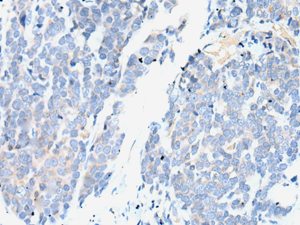 兔抗SMC2多克隆抗体