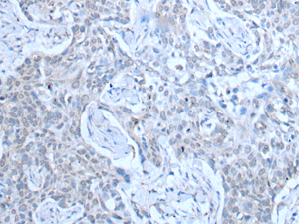 兔抗SMC5多克隆抗体