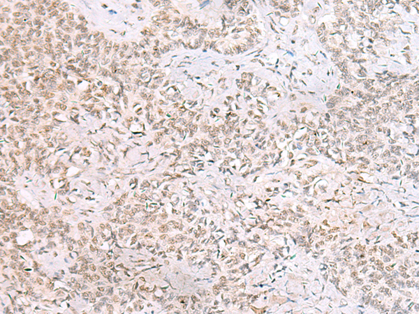 兔抗SMNDC1多克隆抗体