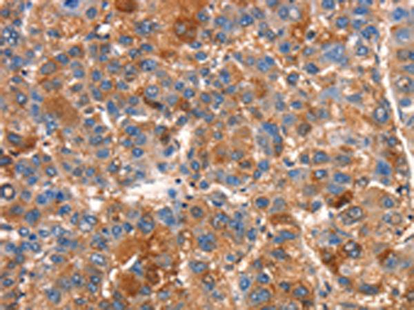 兔抗SMURF1多克隆抗体