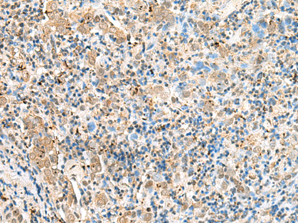 兔抗SNAPC1多克隆抗体