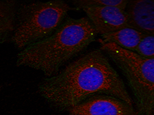 兔抗SNCA (Phospho-Tyr125) 多克隆抗体