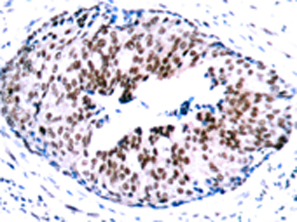 兔抗STAT5A (Phospho-Ser780) 多克隆抗体