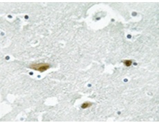 兔抗STK39(Phospho-Ser325) 多克隆抗体