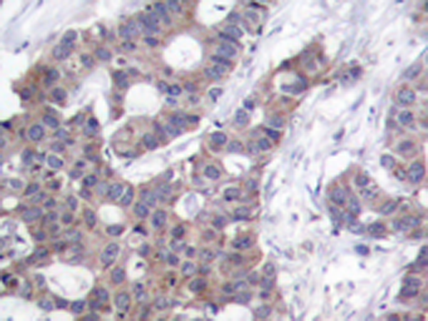 兔抗STMN1 (Phospho-Ser16)多克隆抗体