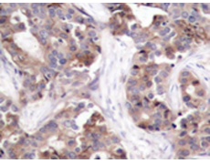 兔抗STMN1 (Phospho-Ser25)多克隆抗体