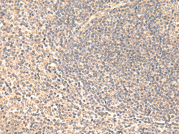 兔抗SULT4A1多克隆抗体