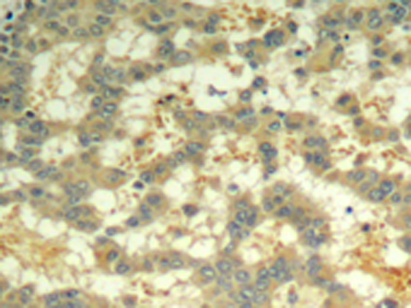 兔抗SYK (phospho-Tyr323)多克隆抗体