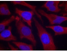 兔抗SYN1 (Phospho-Ser9) 多克隆抗体